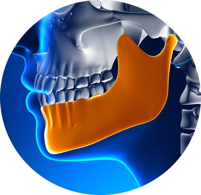 Bone loss jaw bone vector model example.