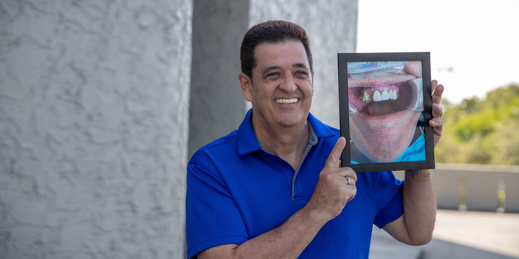 Octavio - dental implant patient