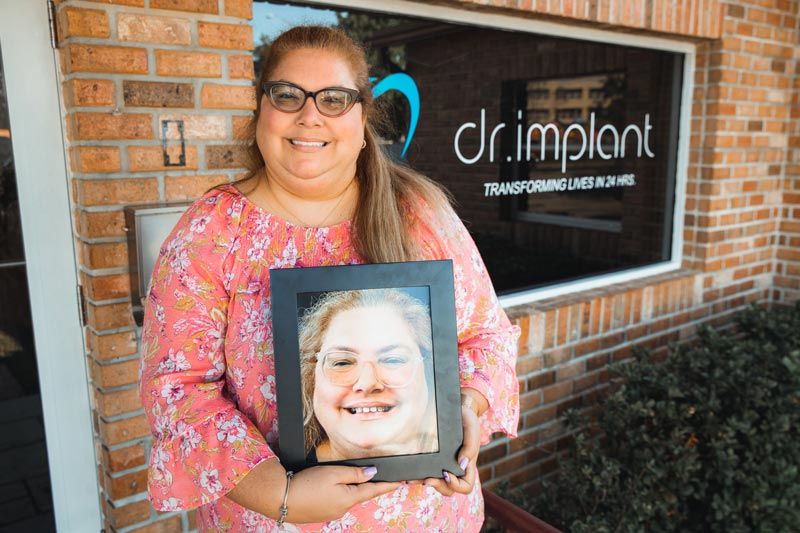 Full-Mouth Reconstruction Patient: Maite