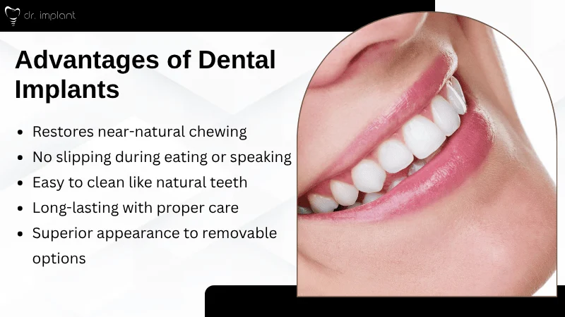 Benefits of Dental Implants