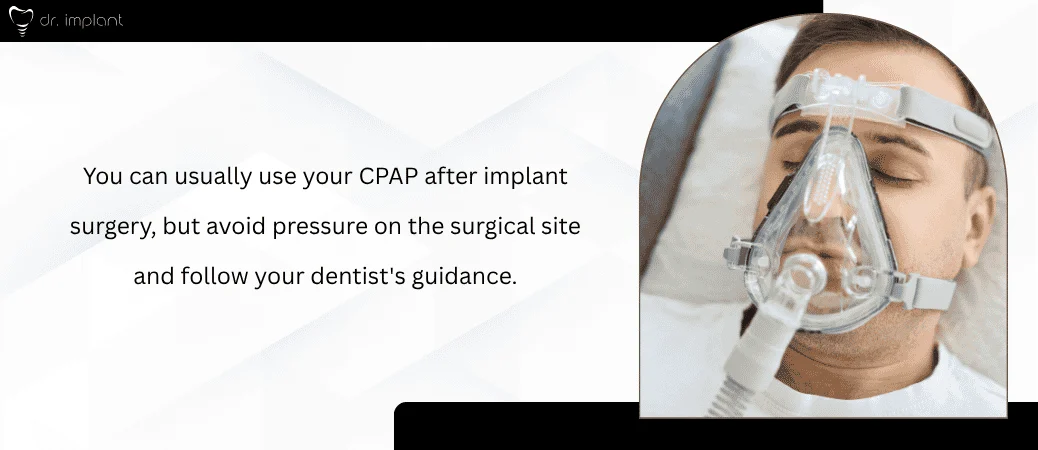 CPAP Use After Implant Surgery