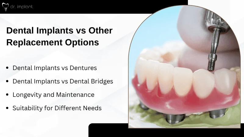 Comparison With Other Tooth Replacement Options