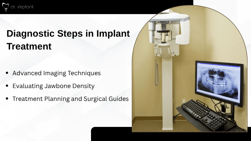 Diagnosis and Assessment in Implant Dentistry