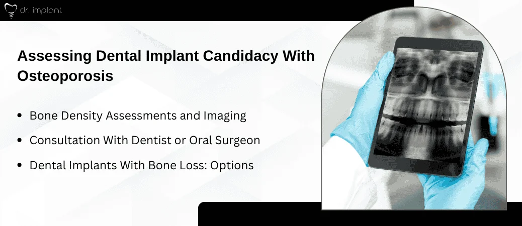Evaluating Eligibility for Implants With Osteoporosis