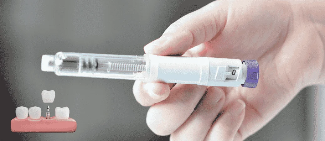GLP 1 medications and dental implant healing