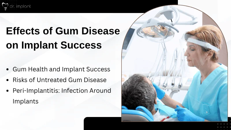 How Gum Disease Impacts Dental Implant Outcomes