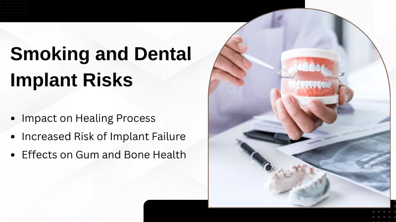 How Smoking Affects Dental Implant Success