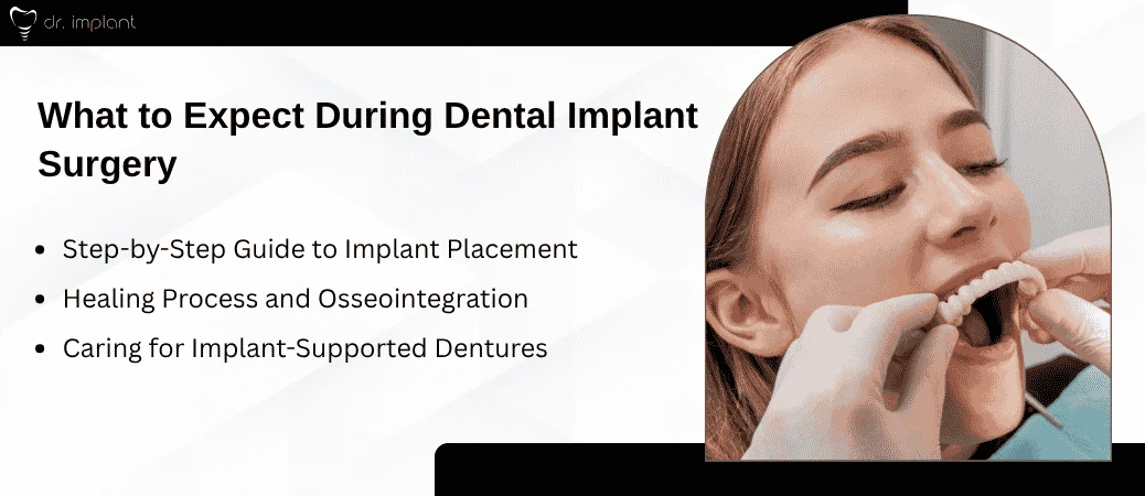 Implant Surgery and What to Expect During Placement