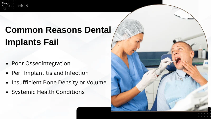 Major Causes of Dental Implant Failure
