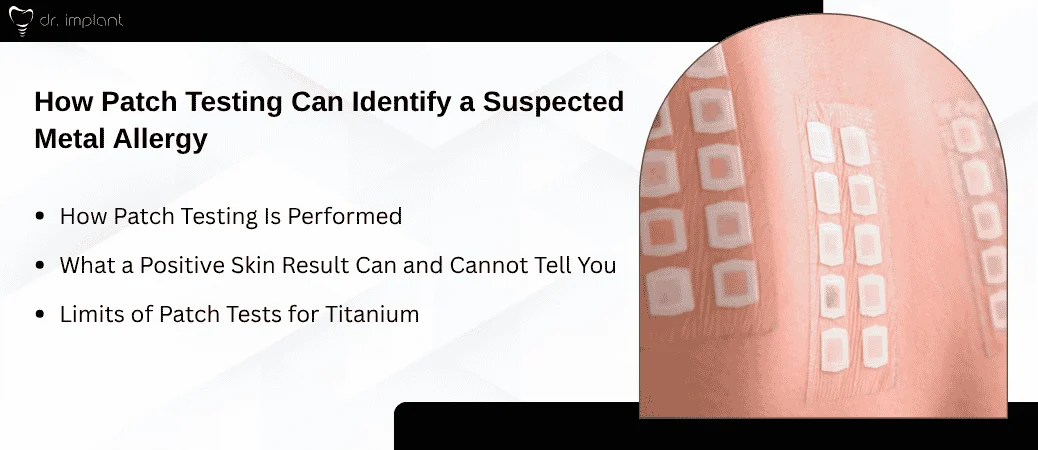 Patch Testing for Suspected Metal Allergy
