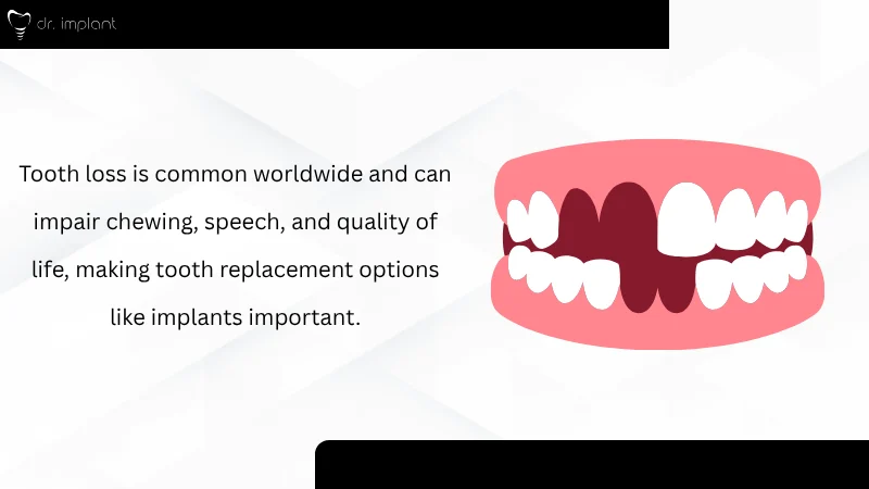 Prevalence of Tooth Loss