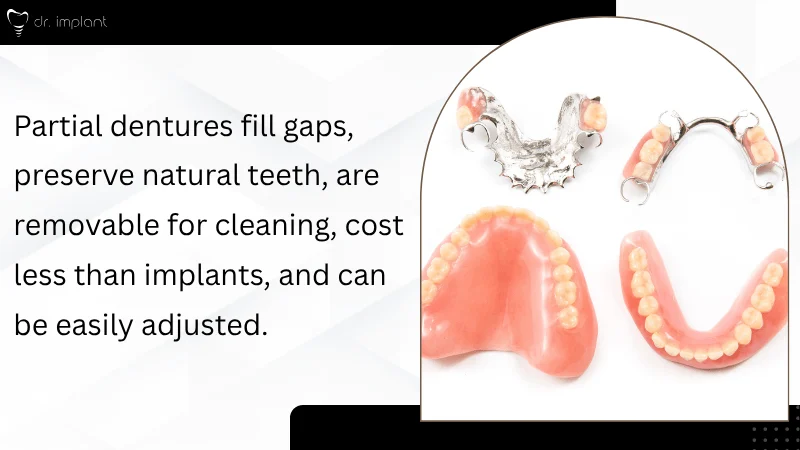 Removable Partial Denture Benefits 