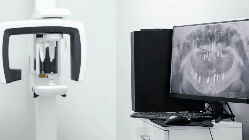 Role of 3D Imaging and Customization