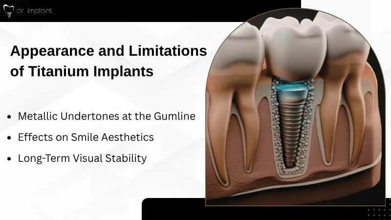Traditional Titanium Implants Appearance and Limitations