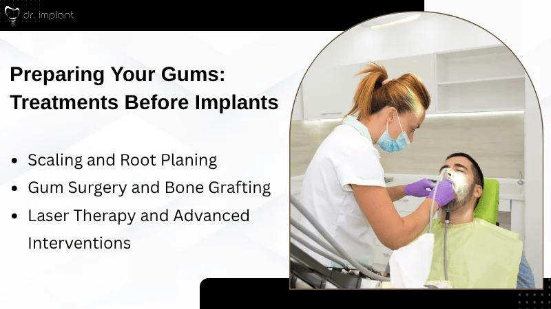 Treatments for Gum Disease Prior to Implants