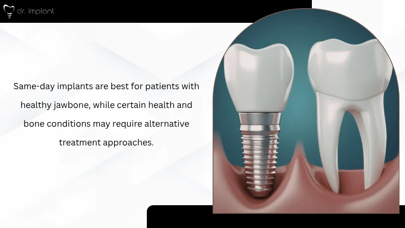 Who Is a Candidate for Same Day Implants