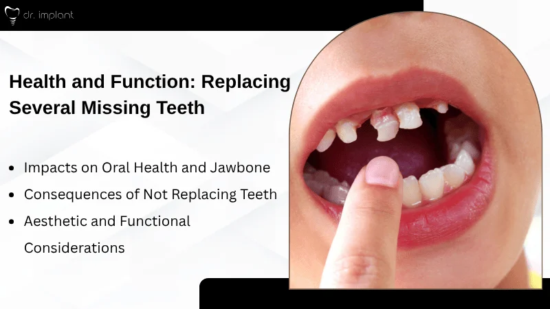 Why Replacing Multiple Missing Teeth Is Essential