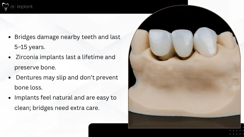 Zirconia Implants vs Bridges and Dentures