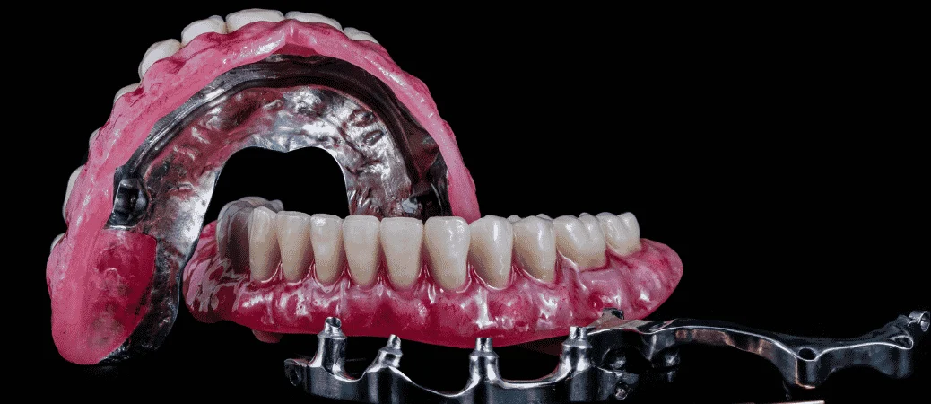 acrylic vs zirconia All-on-4