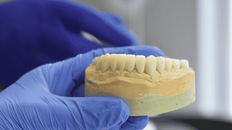 bone loss before dental implants