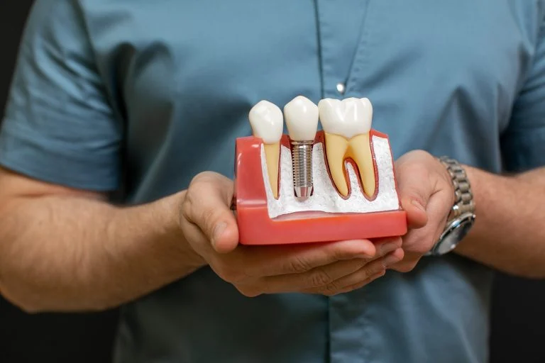 Closeup of the male dentist doctor hands with dental implant model