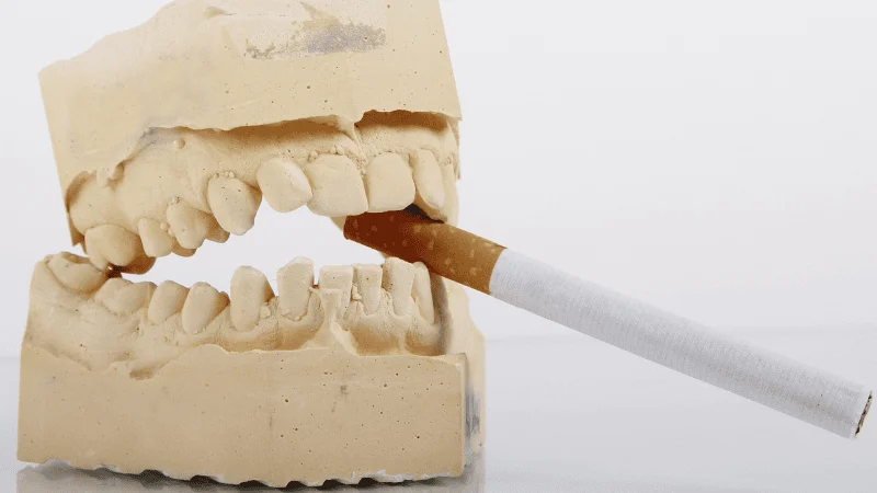 dental implants for smokers