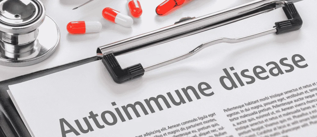 dental implants with autoimmune disease