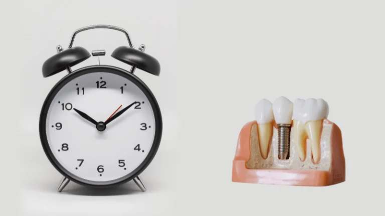 how same day dental implants work