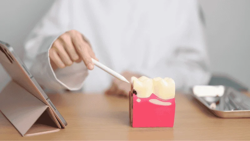 preventing infection after dental implant