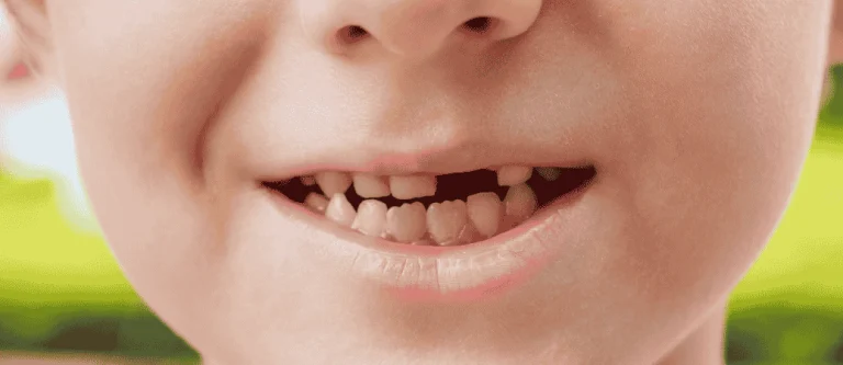 tooth loss statistics South Florida