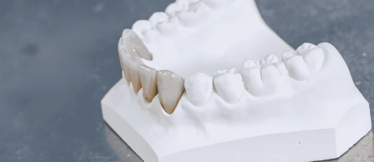 zirconia implant maintenance