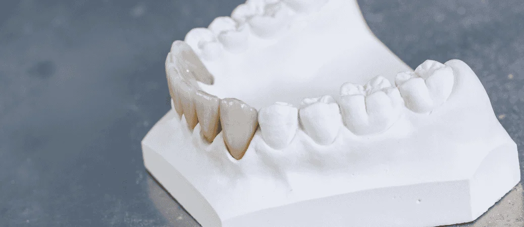 zirconia implant maintenance